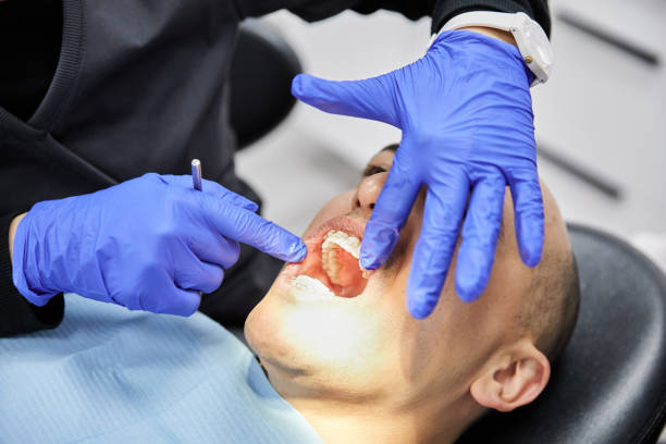 Best Emergency Root Canal Treatment in Ortonville, MI